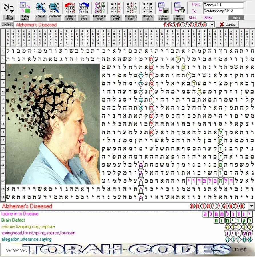 Alzheimer's Diseased